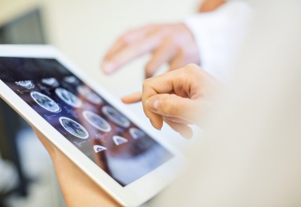 Doctors reviewing scans of a brain