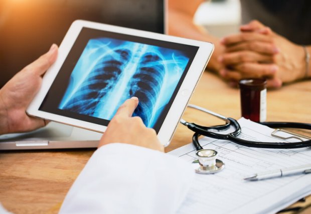 A doctor reviewing an x-ray of lungs